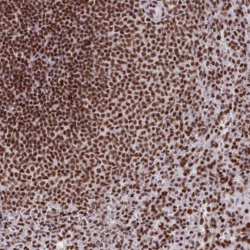 Anti-SNRNP70 antibody produced in rabbit Prestige Antibodies&#174; Powered by Atlas Antibodies, affinity isolated antibody, buffered aqueous glycerol solution