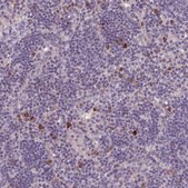 Anti-LAPTM5 antibody produced in rabbit Prestige Antibodies® Powered by Atlas Antibodies, affinity isolated antibody, buffered aqueous glycerol solution