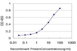 Monoclonal Anti-GATAD2B antibody produced in mouse clone 4C4, purified immunoglobulin, buffered aqueous solution