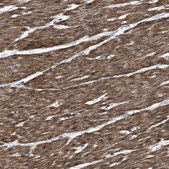 Anti-BAG2 antibody produced in rabbit Prestige Antibodies® Powered by Atlas Antibodies, affinity isolated antibody, buffered aqueous glycerol solution