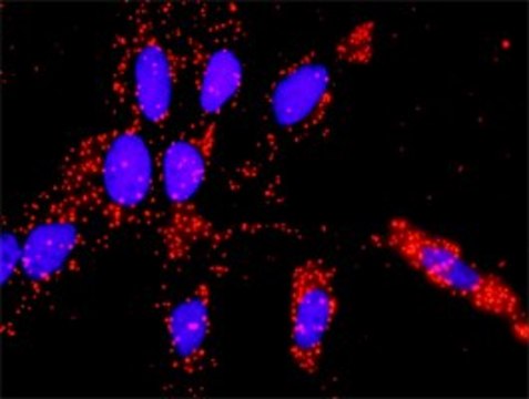 Anti-VEGFB antibody produced in rabbit purified immunoglobulin, buffered aqueous solution