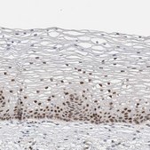 Anti-PUS7 antibody produced in rabbit Prestige Antibodies® Powered by Atlas Antibodies, affinity isolated antibody, buffered aqueous glycerol solution