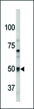 ANTI-PAEL-R (GPR37)(N-TERMINAL) antibody produced in rabbit purified immunoglobulin, buffered aqueous solution