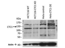 Anti-CST complex subunit CTC1 Antibody, clone C482 clone C482, from mouse