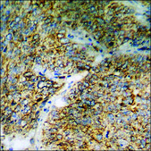 Anti-phospho-ASK1 (pSer83) antibody produced in rabbit affinity isolated antibody