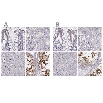 Anti-PBK antibody produced in rabbit Prestige Antibodies&#174; Powered by Atlas Antibodies, affinity isolated antibody