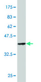 Monoclonal Anti-MLC1SA antibody produced in mouse clone 4G11, purified immunoglobulin, buffered aqueous solution