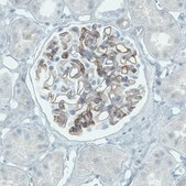 Monoclonal Anti-TSPAN7 antibody produced in mouse Prestige Antibodies® Powered by Atlas Antibodies, clone CL0265, purified immunoglobulin, buffered aqueous glycerol solution