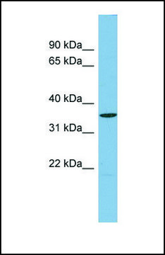 Anti-UCHL5 antibody produced in rabbit affinity isolated antibody