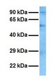 Anti-CASD1, (N-terminal) antibody produced in rabbit affinity isolated antibody