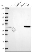 Anti-Acy1 Antibody Produced In Rabbit Prestige Antibodies® Powered by Atlas Antibodies, affinity isolated antibody, buffered aqueous glycerol solution