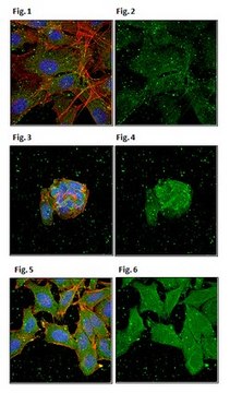 Anti-Tankyrase-1/TNKS Antibody, clone 7D1.2 clone 7D1.2, from mouse