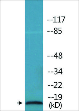 Anti-phospho-STMN1 (pSer62) antibody produced in rabbit affinity isolated antibody