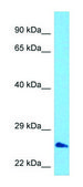 Anti-TIGIT (C-terminal) antibody produced in rabbit affinity isolated antibody