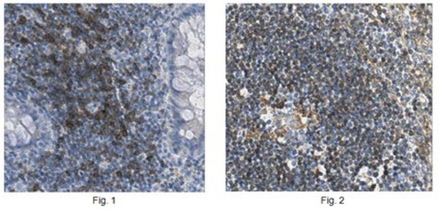 Anti-MTSS1 Antibody, clone 15C3.2 clone 15C3.2, from mouse