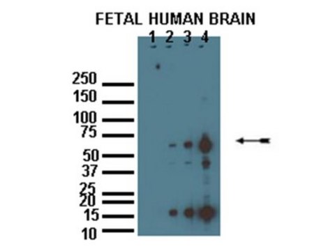 Anti-zDHHC8 Antibody from rabbit, purified by affinity chromatography