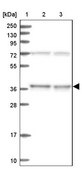 Anti-C11orf54 antibody produced in rabbit Prestige Antibodies® Powered by Atlas Antibodies, affinity isolated antibody, buffered aqueous glycerol solution