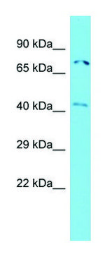 Anti-ACTR8 (N-terminal) antibody produced in rabbit affinity isolated antibody