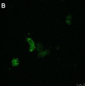 Anti-ATG8 Antibody, clone 2B11 ZooMAb® Rabbit Monoclonal recombinant, expressed in HEK 293 cells