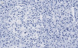 Anti-Helicase MOV-10 Antibody, clone 3B8 ZooMAb® Rabbit Monoclonal recombinant, expressed in HEK 293 cells