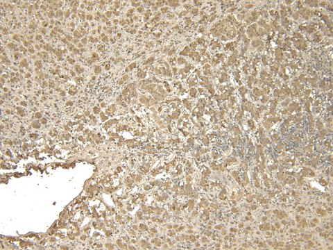 Anti-VMAT2/SLC18A2 antibody produced in goat affinity isolated antibody, buffered aqueous solution