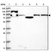 Anti-PPP1R21 antibody produced in rabbit Prestige Antibodies® Powered by Atlas Antibodies, affinity isolated antibody, buffered aqueous glycerol solution