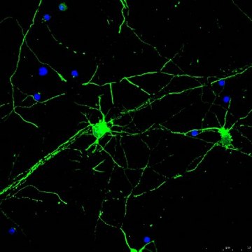 Anti-Beta III Tubulin Antibody, Alexa Fluor&#8482; 488 Conjugate | AB15708A4 from rabbit, ALEXA FLUOR&#8482; 488