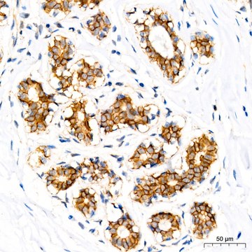 Anti-&#948;-Catenin/p120 Catenin Antibody, clone 5N7Z0, Rabbit Monoclonal