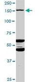 Anti-ABCC11 antibody produced in mouse purified immunoglobulin, buffered aqueous solution