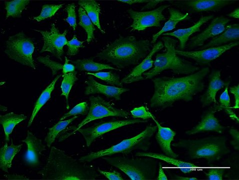 Anti-LDHA antibody produced in mouse purified immunoglobulin, buffered aqueous solution