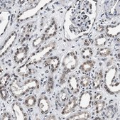 Anti-USP16 antibody produced in rabbit Prestige Antibodies® Powered by Atlas Antibodies, affinity isolated antibody, buffered aqueous glycerol solution