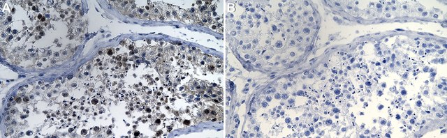 Anti-KANSL2 Antibody, clone 3L12 ZooMAb&#174; Rabbit Monoclonal recombinant, expressed in HEK 293 cells