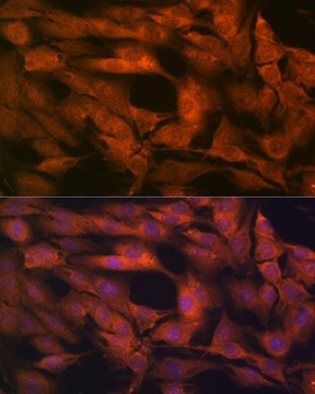 Anti-Laminin beta 1 Antibody, clone 6I9T4, Rabbit Monoclonal