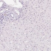 Anti-HOXB13 antibody produced in rabbit Prestige Antibodies® Powered by Atlas Antibodies, affinity isolated antibody, buffered aqueous glycerol solution