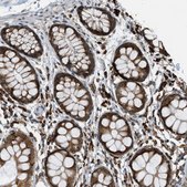 Anti-SEMA4D antibody produced in rabbit Prestige Antibodies® Powered by Atlas Antibodies, affinity isolated antibody, buffered aqueous glycerol solution