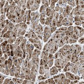 Anti-ETFB antibody produced in rabbit Prestige Antibodies® Powered by Atlas Antibodies, affinity isolated antibody, buffered aqueous glycerol solution, Ab2