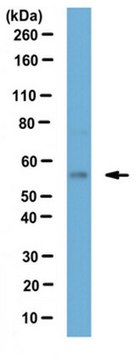 抗-S1P 裂解酶抗体 from rabbit, purified by affinity chromatography