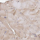 Anti-TRIM55 antibody produced in rabbit affinity isolated antibody, buffered aqueous glycerol solution