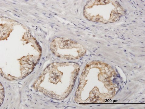 Anti-SORD antibody produced in mouse purified immunoglobulin, buffered aqueous solution