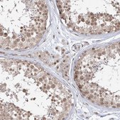 Anti-SNRNP27 antibody produced in rabbit Prestige Antibodies® Powered by Atlas Antibodies, affinity isolated antibody, buffered aqueous glycerol solution