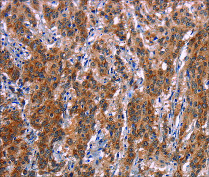 Anti-FDCSP antibody produced in rabbit affinity isolated antibody