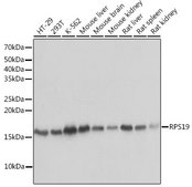 Anti-RPS19 antibody produced in rabbit