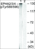 Anti-phospho-EPHA2/3/4 (pTyr588/596) antibody produced in rabbit affinity isolated antibody