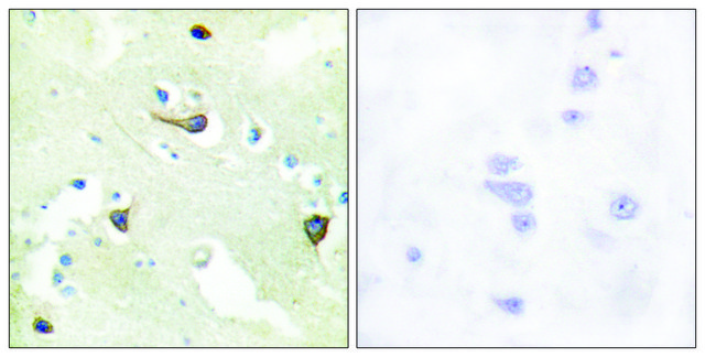 Anti-EPHB1 antibody produced in rabbit affinity isolated antibody