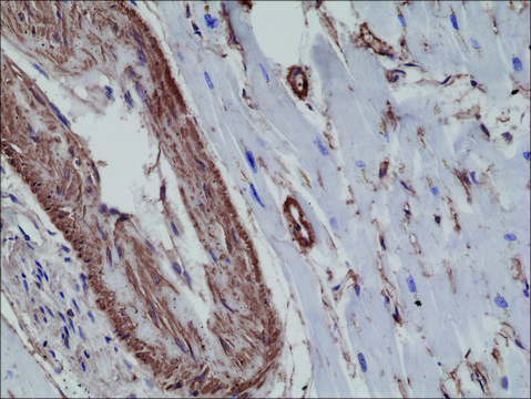 Anti-ACTA2 antibody, Rabbit monoclonal recombinant, expressed in HEK 293 cells, clone RM253, purified immunoglobulin