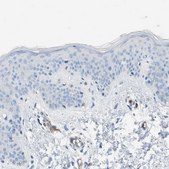 Anti-DYSF antibody produced in rabbit Prestige Antibodies® Powered by Atlas Antibodies, affinity isolated antibody, buffered aqueous glycerol solution