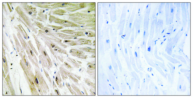 Anti-RPL22 antibody produced in rabbit affinity isolated antibody