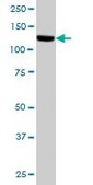 Monoclonal Anti-TAOK1 antibody produced in mouse clone 4E12, purified immunoglobulin, buffered aqueous solution
