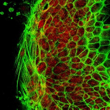 Anti-Pumilio-2 (PUM2) Antibody from rabbit, purified by affinity chromatography