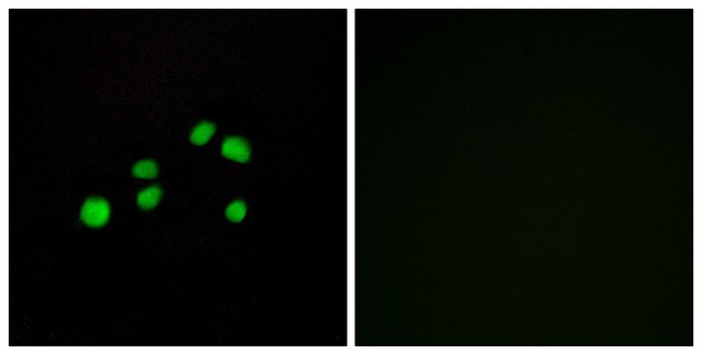 Anti-Collagen XXIII &#945;1 antibody produced in rabbit affinity isolated antibody